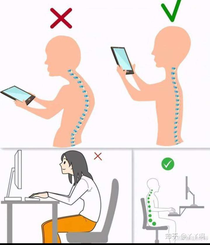 手机游戏肩健-玩手机游戏也要保护肩膀！这些方法你get了吗？